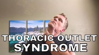 How to get rid of Thoracic Outlet Syndrome (Top 3 Stretches)