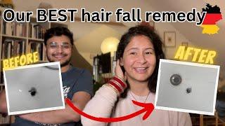 My Hair fall story in Germany |  Remedies to control hair fall in Germany