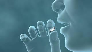 Darmkrebs-Vorsorge | PillCam Colon | Medtronic