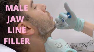  Male Jawline Fillers Before And After  Dr Nina Bal Jawline Transformation