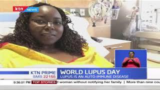 Globe marks World Lupus Day as 700,000 Kenyans estimated to be living with Lupus
