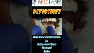 Graphene single tooth cad camMilled for single implant upper premolar replacement Chennai India! ##