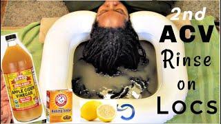 ACV Rinse for Locs | 5 YEARS Loc'd | Naturally Michy