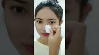 Cabut sampai keakar-akarnya | bye bye komedo