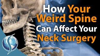 How Your Weird Spine can Affect Your Neck Surgery