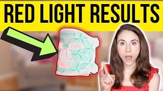 DO LED LIGHT MASKS REALLY WORK? | Dermatologist reviews Omnilux