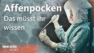 Affenpocken in Deutschland: Das wissen wir bisher | Aktuelle Stunde