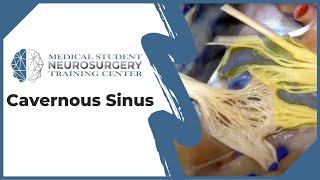 Cavernous Sinus