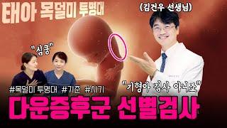 기형아 검사 아닙니다 '다운증후군' 선별검사 입니다! (김건우 선생님) 『임신과 출산』 6번째 이야기. ‍산부인과 의사 3인이 풀어가는 유익한 의학채널
