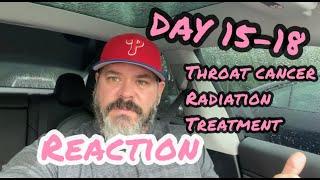 WHAT TO EXPECT | Throat Cancer | Radiation Treatment to cure my cancer | My Reactions Day 15-18