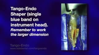 Tango-Endo Instrumentation: Completed in a plastic tooth for viewing