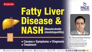 Fatty Liver Disease & NASH (Nonalcoholic Steatohepatitis)  - Causes, Symptoms, Diagnosis & Treatment