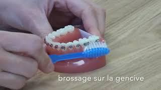 Comment brosser ses dents avec un appareil ?