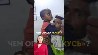 ⁉️ ЧТО ДЕЛАТЬ, ЕСЛИ УКУСИЛО ЖИВОТНОЕ? #педиатр #врач #бешенство