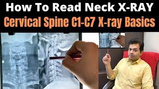 How to read Neck x ray, How to read x ray of Cervical spine, Cervical Spine x ray Reading C1-C7