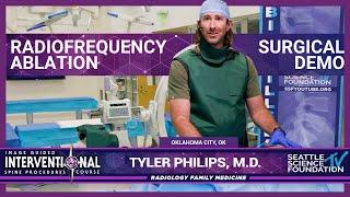 Radiofrequency Ablation -Tyler Phillips, M.D.