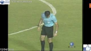 Municipal vs Antigua