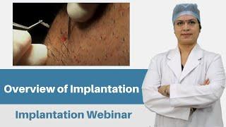 Overview of Implantation | Implantation Webinar | Dr. Seema Garg | Indore | AHRS - INDIA