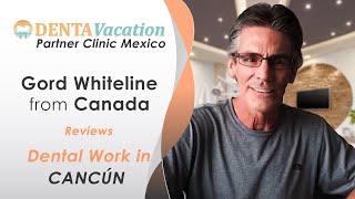 Dental Implants at Cancún Dental Specialists, Mexico | DentaVacation Partner Hospital