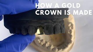 How A Gold Crown Is Made