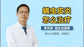 螨虫皮炎怎么治疗 有来医生