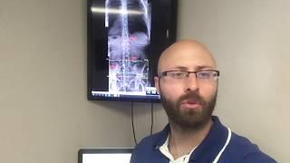 San Diego Chiropractor Takes X-Rays - Gonstead Family Chiropractic Dr Zach Beatty, DC