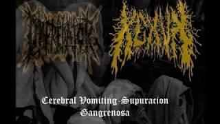 Cerebral Vomiting & Depredator-Dystrophic Endometritis Split (2016)