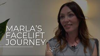 Facelift Journey at L&P Aesthetics | 50 Year Old Marla | Bay Area's Best Facial Plastic Surgeons