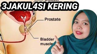 3JAKUL4S1 RETROGRADE / KERING PENYEBAB KEMANDULAN