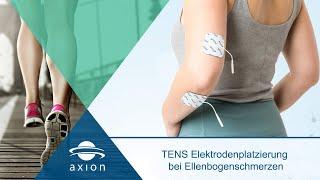 Ellenbogenschmerzen - Elektrodenplatzierung für TENS | axion