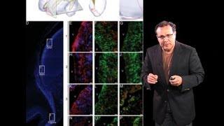 Alfredo Quiñones-Hinojosa (Johns Hopkins) Part 2: Stem Cells and Brain Tumors