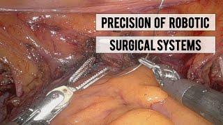 Precision of Robotic Surgical Systems