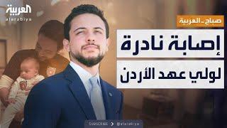 صباح العربية | إصابة ولي العهد الأردني بحالة طبية نادرة بعد الأبوة.. ما قصتها؟