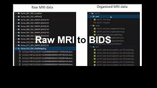 Organising your neuroimaging data. Part 1: MRI