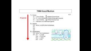 TNM-Klassifikation (Stadieneinteilung) | Strahlentherapie Prof. Hilke Vorwerk