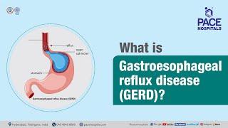 What is Gastroesophageal Reflux Disease (GERD)?  | PACE Hospitals #shortvideo #gerd