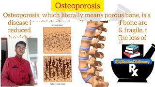 Osteoporosis ll Definition in Hindi ll Symptoms , Course , Treatment ll @SG Pharma Dictionary1M