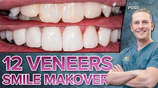 Wirklich? 12 Veneers + Implantate - Smile Makeover im Ober- und Unterkiefer