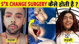 देखिये लड़की से लड़का बनने की सर्जरी कैसे की जाती है Male To Female Gender Change Surgery Process