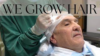 Does a Hair Transplant HURT?