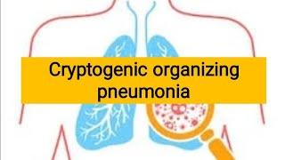 Cryptogenic organizing pneumonia |Restrictive lung Diseases