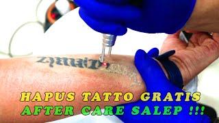 HAPUS TATTO GRATIS AFTER CARE SALEP !!!, Remove Tattoo For Free After Care Salep