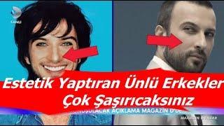 Estetik Yaptıran Ünlü Erkekler Çok Şaşırıcaksınız Tarkan, Kerimcan Durmaz... - Magazin Haberleri