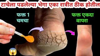 एकदा हळद वापरा टाचेला पडलेल्या भेगा रात्रीत ठीक होतील  Marathi kitchen / kitchen tips / recipe