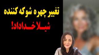 تغییر چهره شوکه کننده شیلا خداداد که باور نمیکنید!چرا اینجوری شد یهو؟؟؟