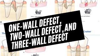 One-wall defect, two-wall defect, and three-wall defect