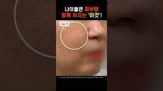 프락셀 받으면 엄청 아프고 부작용에 효과도 없다? NO! 프락셀 제대로 받고 모공 소멸 시키기 #모공 #모공관리 #프락셀 #모즈클리닉 #modsclinic