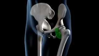Hip Joint Range of Movement - 3D Medical Animation || ABP ©