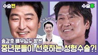 눈빛 연기의 “대가” 송강호 배우의 성형 고백?! #중년성형 #상안검