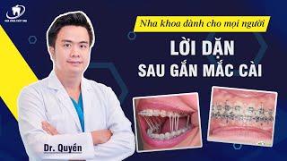 Lời dặn sau khi gắn mắc cài niềng răng